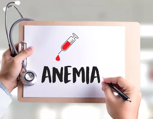 Anemia Memperparah Risiko Kematian pada Syok Septik Anak: Peran Stres Oksidatif dan Antioksidan